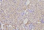 AMFR Antibody in Immunohistochemistry (IHC)