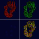 IRG1 Antibody in Immunocytochemistry (ICC/IF)