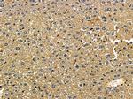 SRM Antibody in Immunohistochemistry (Paraffin) (IHC (P))