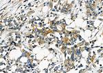 PPT1 Antibody in Immunohistochemistry (Paraffin) (IHC (P))