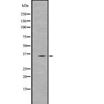 PPT1 Antibody in Western Blot (WB)