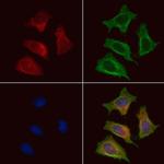 CD21 Antibody in Immunocytochemistry (ICC/IF)