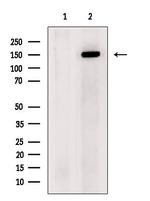 CD21 Antibody in Western Blot (WB)