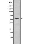 Phospho-PKM2 (Tyr105) Antibody in Western Blot (WB)