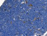 Phospho-PKM2 (Ser37) Antibody in Immunohistochemistry (Paraffin) (IHC (P))