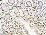 Phospho-PKM2 (Ser37) Antibody in Immunohistochemistry (Paraffin) (IHC (P))