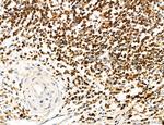 Phospho-PKM2 (Ser37) Antibody in Immunohistochemistry (Paraffin) (IHC (P))