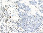 Phospho-PKM2 (Ser37) Antibody in Immunohistochemistry (Paraffin) (IHC (P))