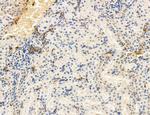 Phospho-PKM2 (Ser37) Antibody in Immunohistochemistry (Paraffin) (IHC (P))