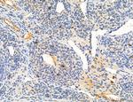 Phospho-PKM2 (Ser37) Antibody in Immunohistochemistry (Paraffin) (IHC (P))