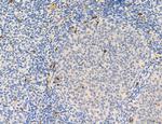 Phospho-PKM2 (Ser37) Antibody in Immunohistochemistry (Paraffin) (IHC (P))