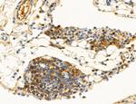 Phospho-PKM2 (Ser37) Antibody in Immunohistochemistry (Paraffin) (IHC (P))