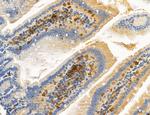 Phospho-PKM2 (Ser37) Antibody in Immunohistochemistry (Paraffin) (IHC (P))