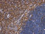 Phospho-PKM2 (Ser37) Antibody in Immunohistochemistry (Paraffin) (IHC (P))