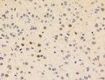 Phospho-PKM2 (Ser37) Antibody in Immunohistochemistry (Paraffin) (IHC (P))