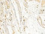 Phospho-PKM2 (Ser37) Antibody in Immunohistochemistry (Paraffin) (IHC (P))