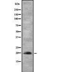 MYL12A Antibody in Western Blot (WB)