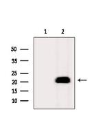 MYL12A Antibody in Western Blot (WB)