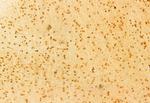 PLD1 Antibody in Immunohistochemistry (Paraffin) (IHC (P))