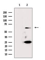 Cdc6 Antibody in Western Blot (WB)