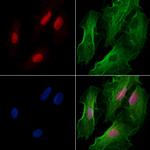 CTNNBL1 Antibody in Immunocytochemistry (ICC/IF)