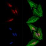 HB9 Antibody in Immunocytochemistry (ICC/IF)