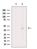 HB9 Antibody in Western Blot (WB)