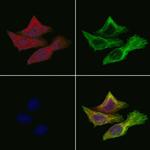 MT-CO2 Antibody in Immunocytochemistry (ICC/IF)