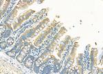 MT-CO2 Antibody in Immunohistochemistry (Paraffin) (IHC (P))