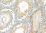 MT-CO2 Antibody in Immunohistochemistry (Paraffin) (IHC (P))