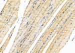 MT-CO2 Antibody in Immunohistochemistry (Paraffin) (IHC (P))