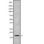 AP2S1 Antibody in Western Blot (WB)