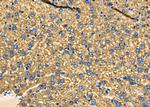 PUM1 Antibody in Immunohistochemistry (Paraffin) (IHC (P))