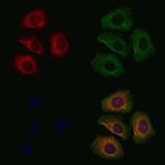 EYA2 Antibody in Immunocytochemistry (ICC/IF)