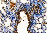 hCG beta-2 Antibody in Immunohistochemistry (Paraffin) (IHC (P))