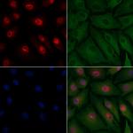 HIPK2 Antibody in Immunocytochemistry (ICC/IF)