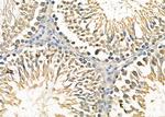 CAB39 Antibody in Immunohistochemistry (Paraffin) (IHC (P))