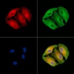 alpha Actinin 3 Antibody in Immunocytochemistry (ICC/IF)