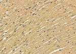 alpha Actinin 3 Antibody in Immunohistochemistry (Paraffin) (IHC (P))