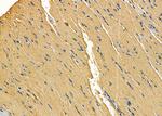 alpha Actinin 3 Antibody in Immunohistochemistry (Paraffin) (IHC (P))