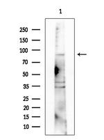 alpha Actinin 3 Antibody in Western Blot (WB)