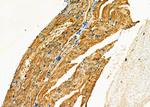 TRIM29 Antibody in Immunohistochemistry (Paraffin) (IHC (P))