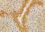 TRIM29 Antibody in Immunohistochemistry (Paraffin) (IHC (P))