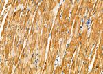 TRIM29 Antibody in Immunohistochemistry (Paraffin) (IHC (P))