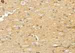 TRIM29 Antibody in Immunohistochemistry (Paraffin) (IHC (P))