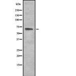 TRIM29 Antibody in Western Blot (WB)