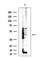 TRIM29 Antibody in Western Blot (WB)