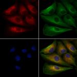 PTP4A2 Antibody in Immunocytochemistry (ICC/IF)