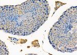 PTP4A2 Antibody in Immunohistochemistry (Paraffin) (IHC (P))