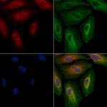 TRIP10 Antibody in Immunocytochemistry (ICC/IF)